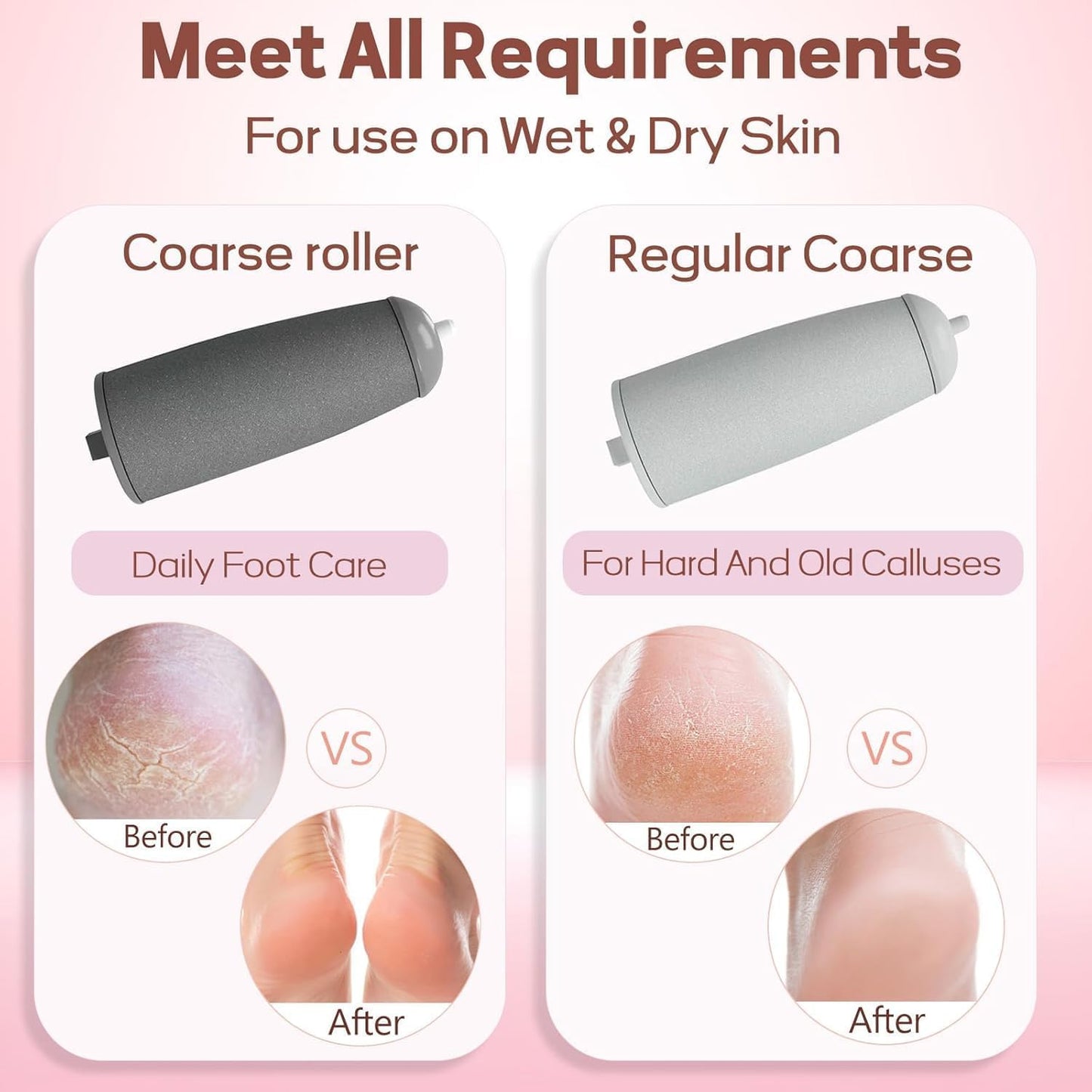 SPAREQUE Callus Remover for Feet – Rechargeable Pedicure Tool for Dead Skin & Cracked Heels