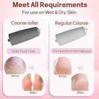 SPAREQUE Callus Remover for Feet – Rechargeable Pedicure Tool for Dead Skin & Cracked Heels