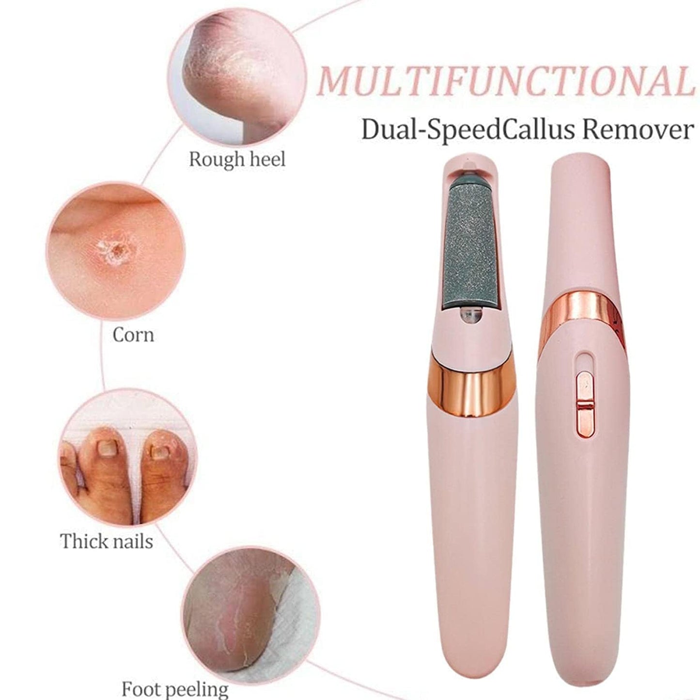 SPAREQUE Callus Remover for Feet – Rechargeable Pedicure Tool for Dead Skin & Cracked Heels